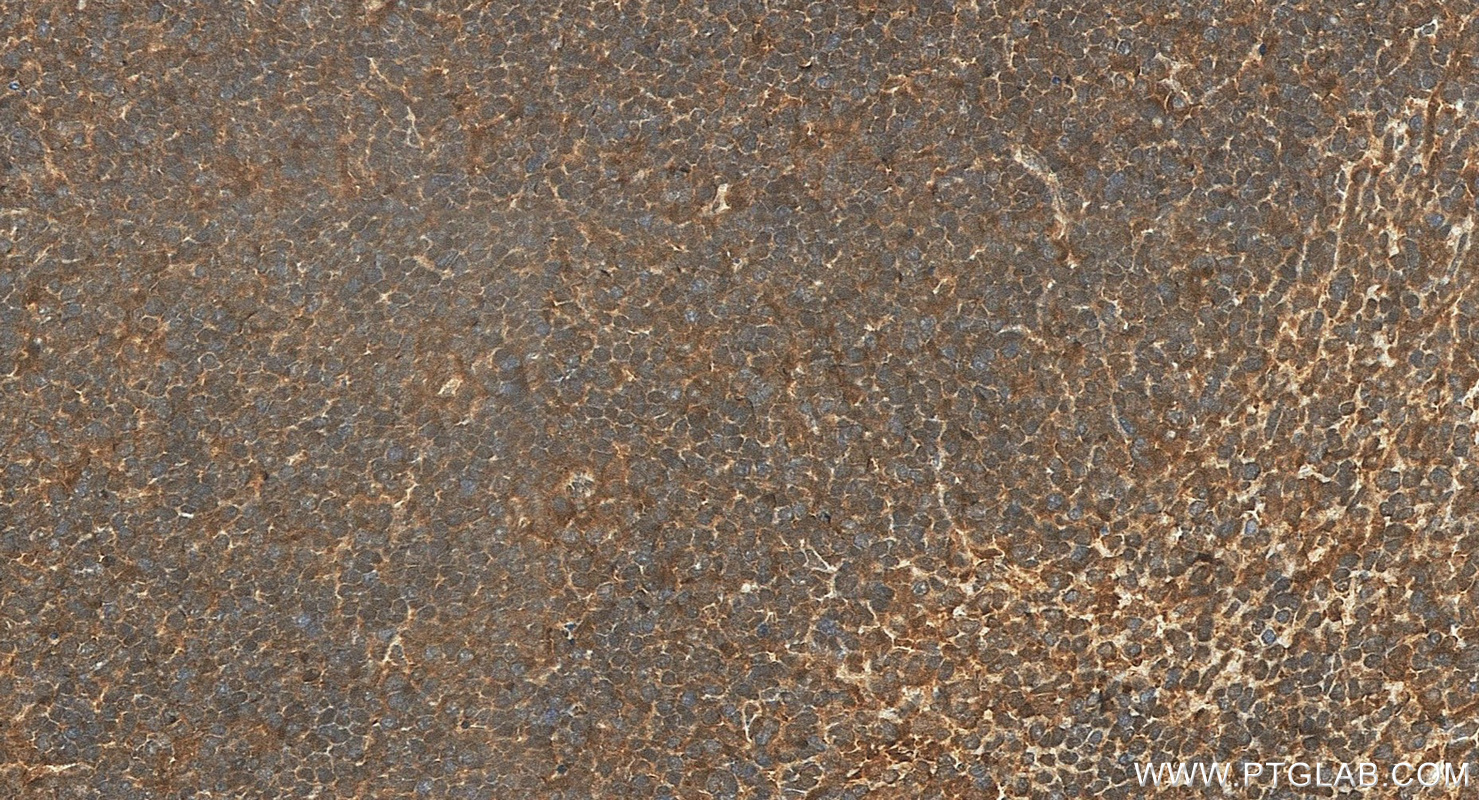 IHC staining of mouse spleen using 14717-1-AP