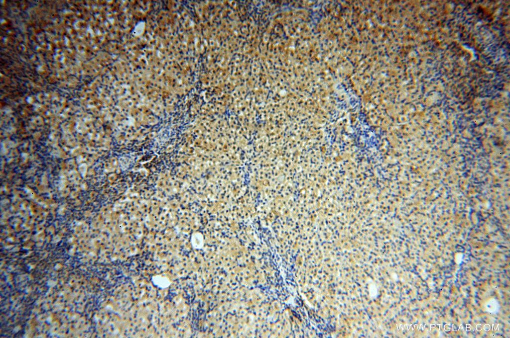 IHC staining of human ovary using 14717-1-AP