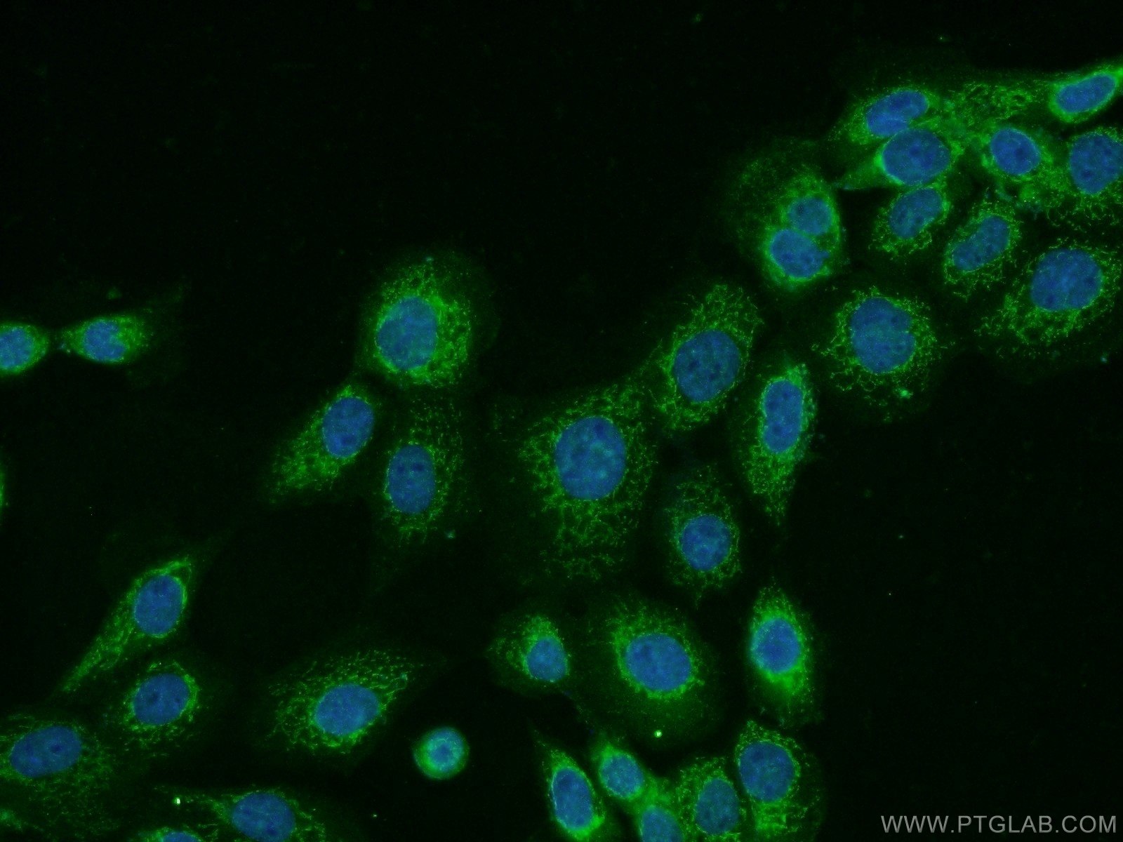 IF Staining of A431 using 17759-1-AP