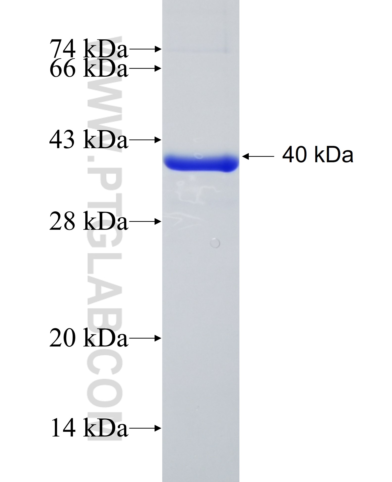 CNDP1 fusion protein Ag12251 SDS-PAGE CNDP1 fusion protein Ag12251 SDS-PAGE