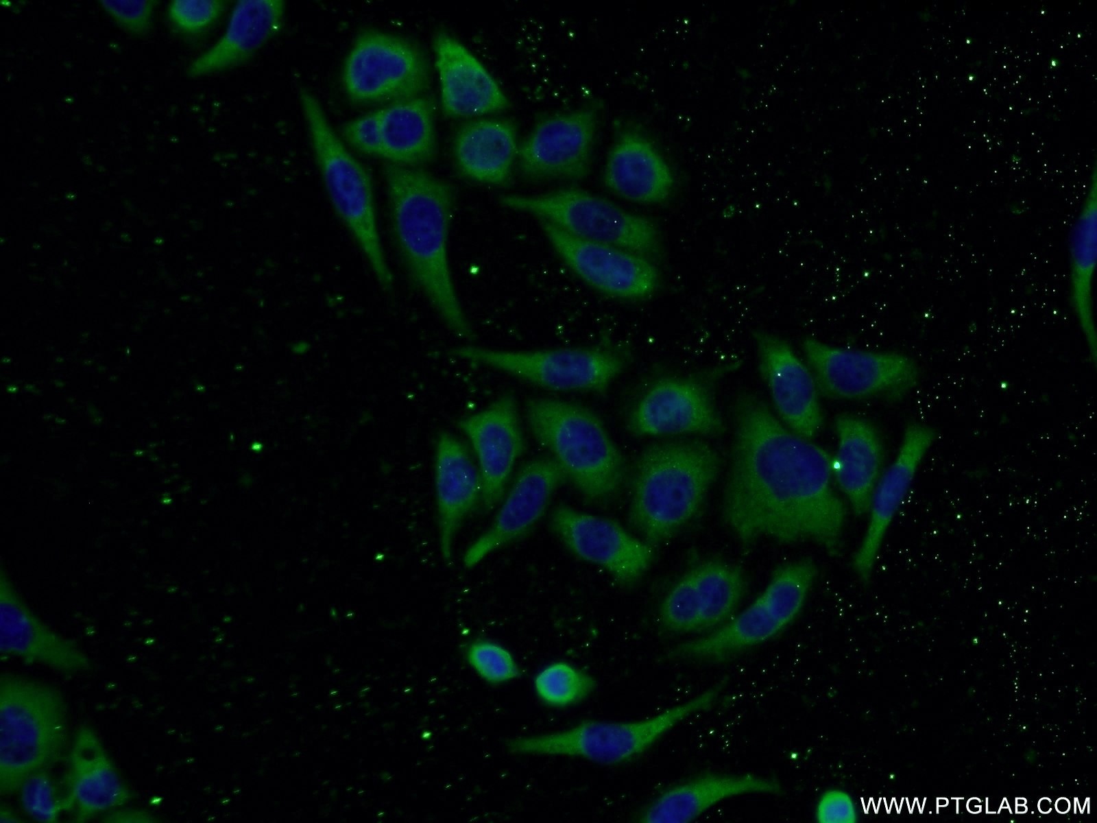 IF Staining of PC-3 using 14925-1-AP