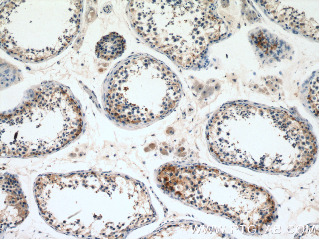 IHC staining of human testis using 14925-1-AP