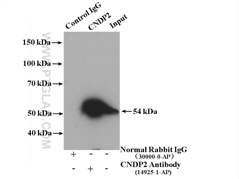 IP experiment of mouse testis using 14925-1-AP