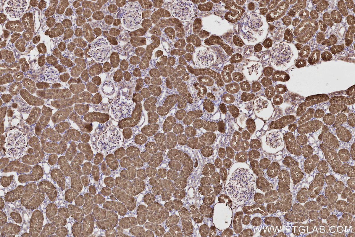 IHC staining of rat kidney using 84924-7-RR IHC staining of rat kidney using 84924-7-RR