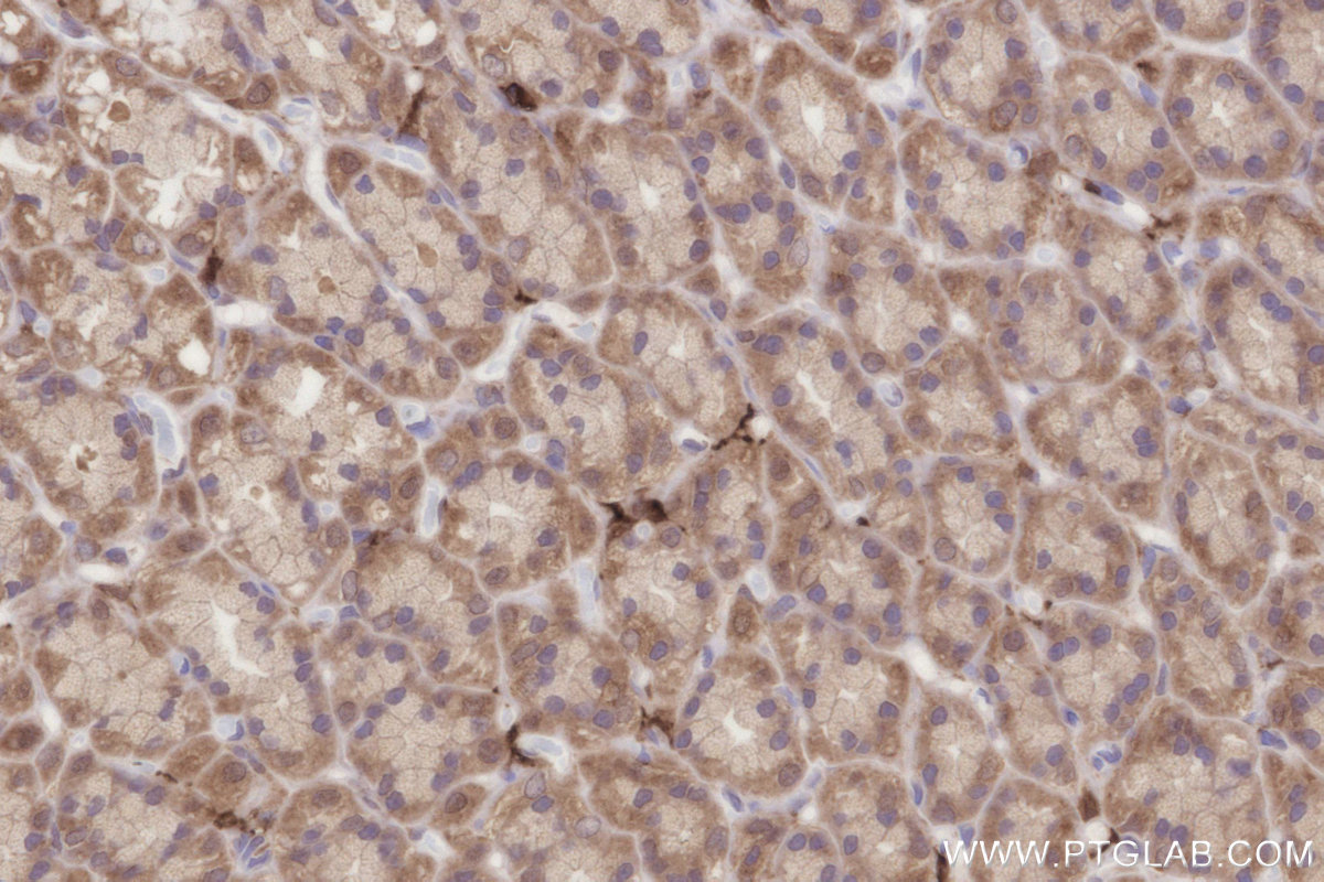 IHC staining of rat stomach using 84924-7-RR