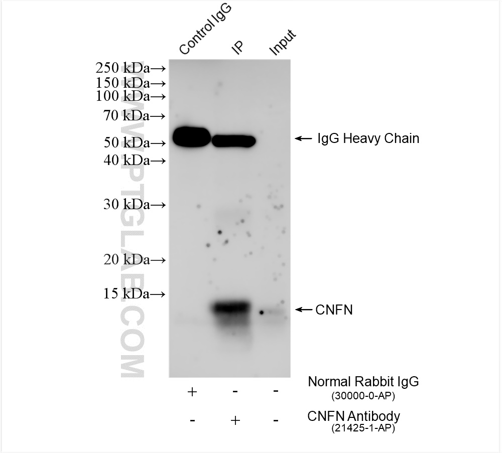IP experiment of mouse skin using 21425-1-AP (same clone as 21425-1-PBS)