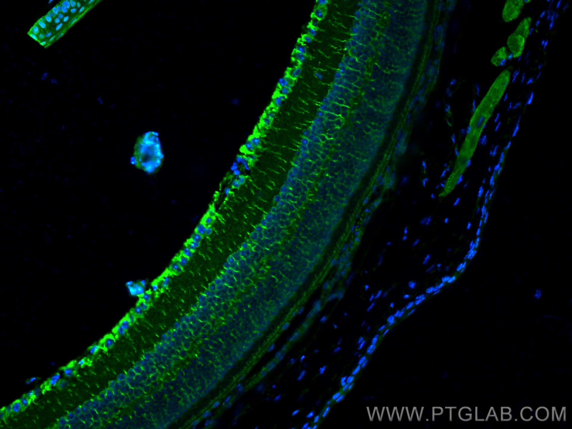 IF Staining of mouse eye using 30557-1-AP