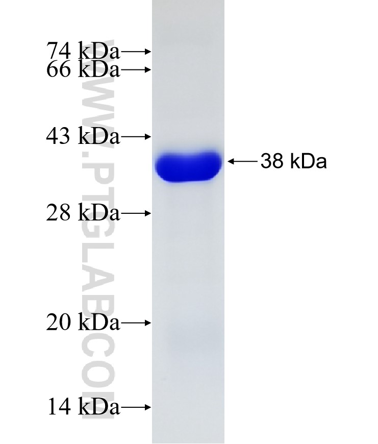 CNGB3 fusion protein Ag23276 SDS-PAGE