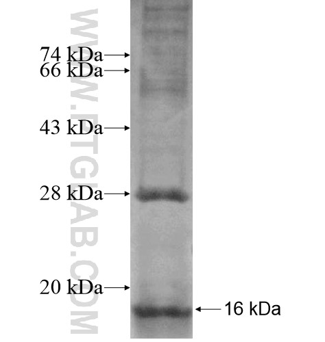 CNIH fusion protein Ag12512 SDS-PAGE CNIH fusion protein Ag12512 SDS-PAGE