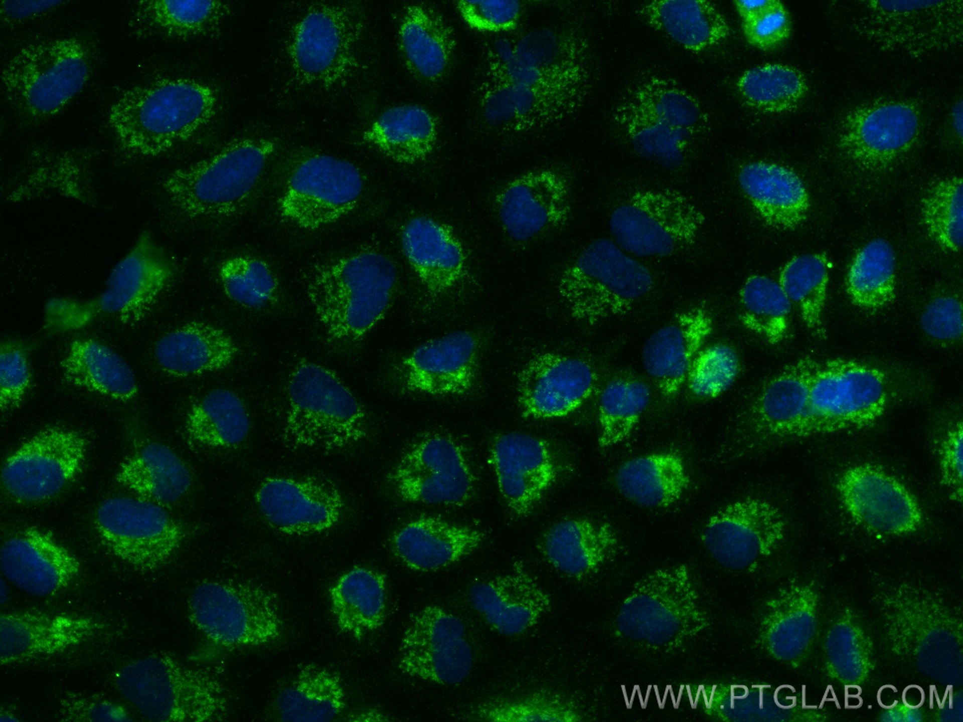 IF Staining of A549 using 14260-1-AP
