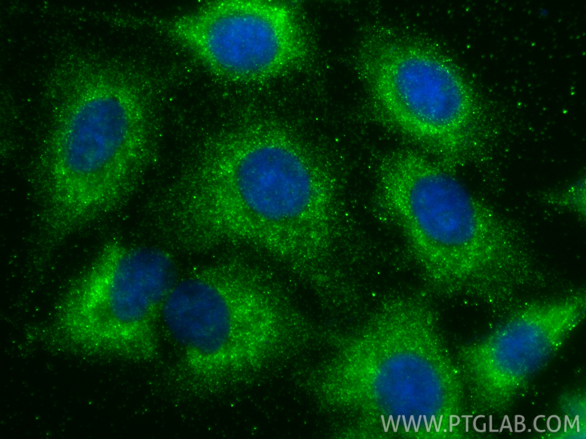 Immunofluorescent analysis of (-20°C Methanol) fixed A549 cells using CNIH2 antibody (14260-1-AP) at dilution of 1:200 and CoraLite®488-Conjugated Goat Anti-Rabbit IgG(H+L) (<a class='green' href='/productredirect?CatalogNo=SA00013-2' target='_blank'>SA00013-2</a>). IF Staining of A549 using 14260-1-AP