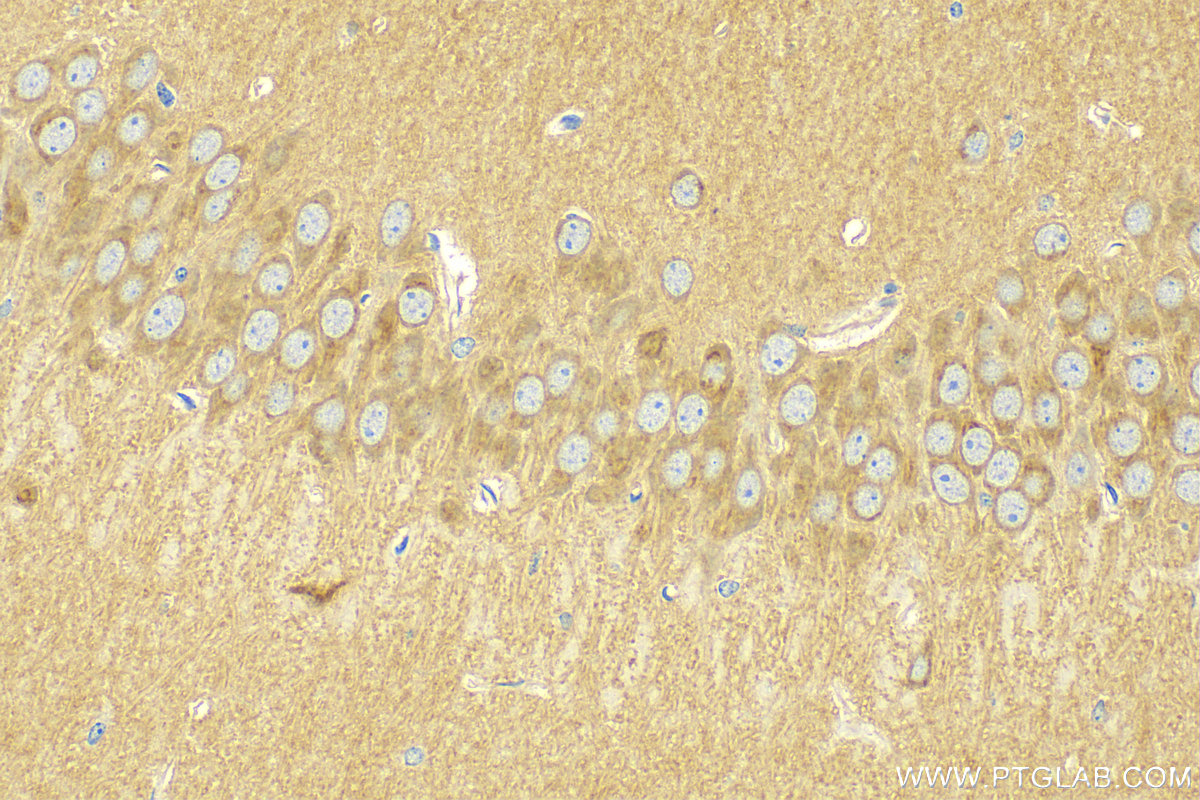 IHC staining of mouse brain using 14260-1-AP