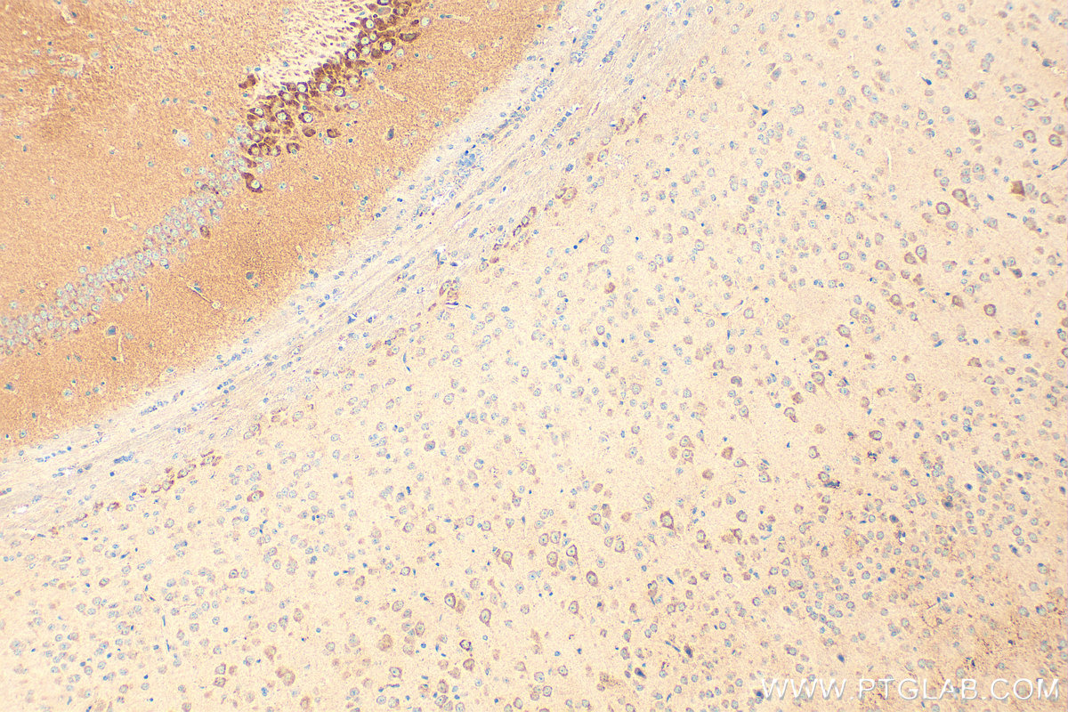 IHC staining of mouse brain using 14260-1-AP
