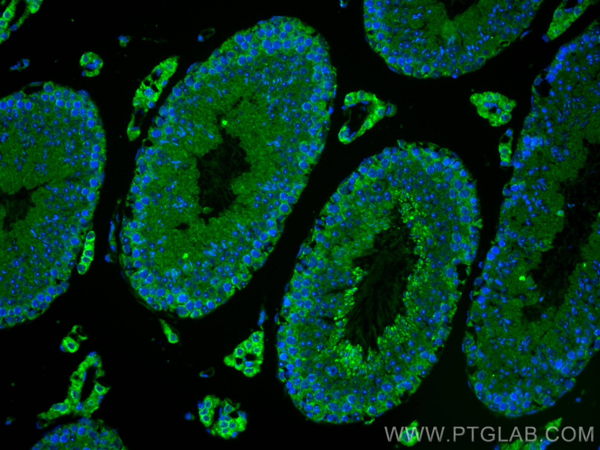 IF Staining of mouse testis using 15015-1-AP