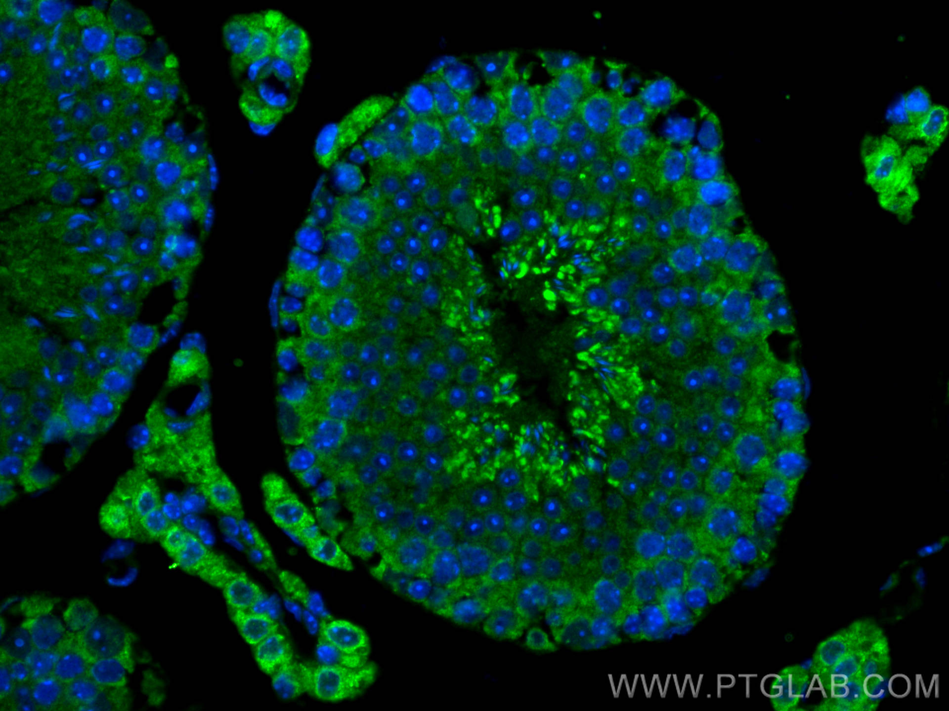 IF Staining of mouse testis using 15015-1-AP