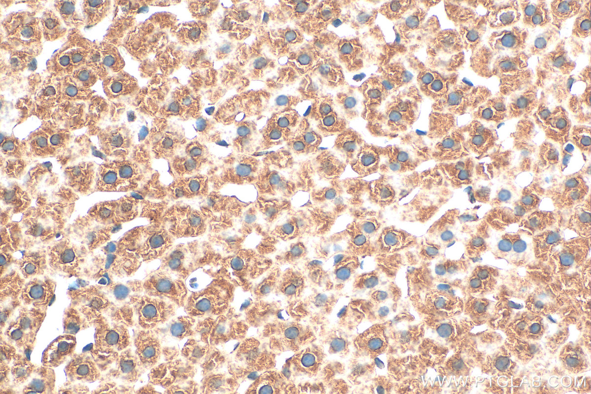 Immunohistochemical analysis of paraffin-embedded rat liver tissue slide using 24054-1-AP (CNKSR2 antibody) at dilution of 1:100 (under 40x lens). Heat mediated antigen retrieval with Tris-EDTA buffer (pH 9.0). IHC staining of rat liver using 24054-1-AP