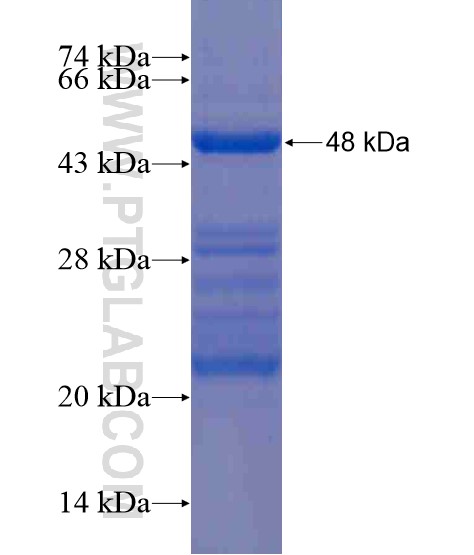 CNKSR2 fusion protein Ag21174 SDS-PAGE