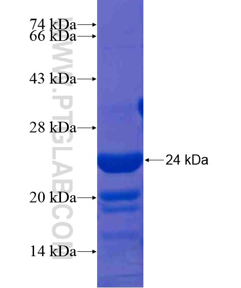 CNKSR2 fusion protein Ag21183 SDS-PAGE