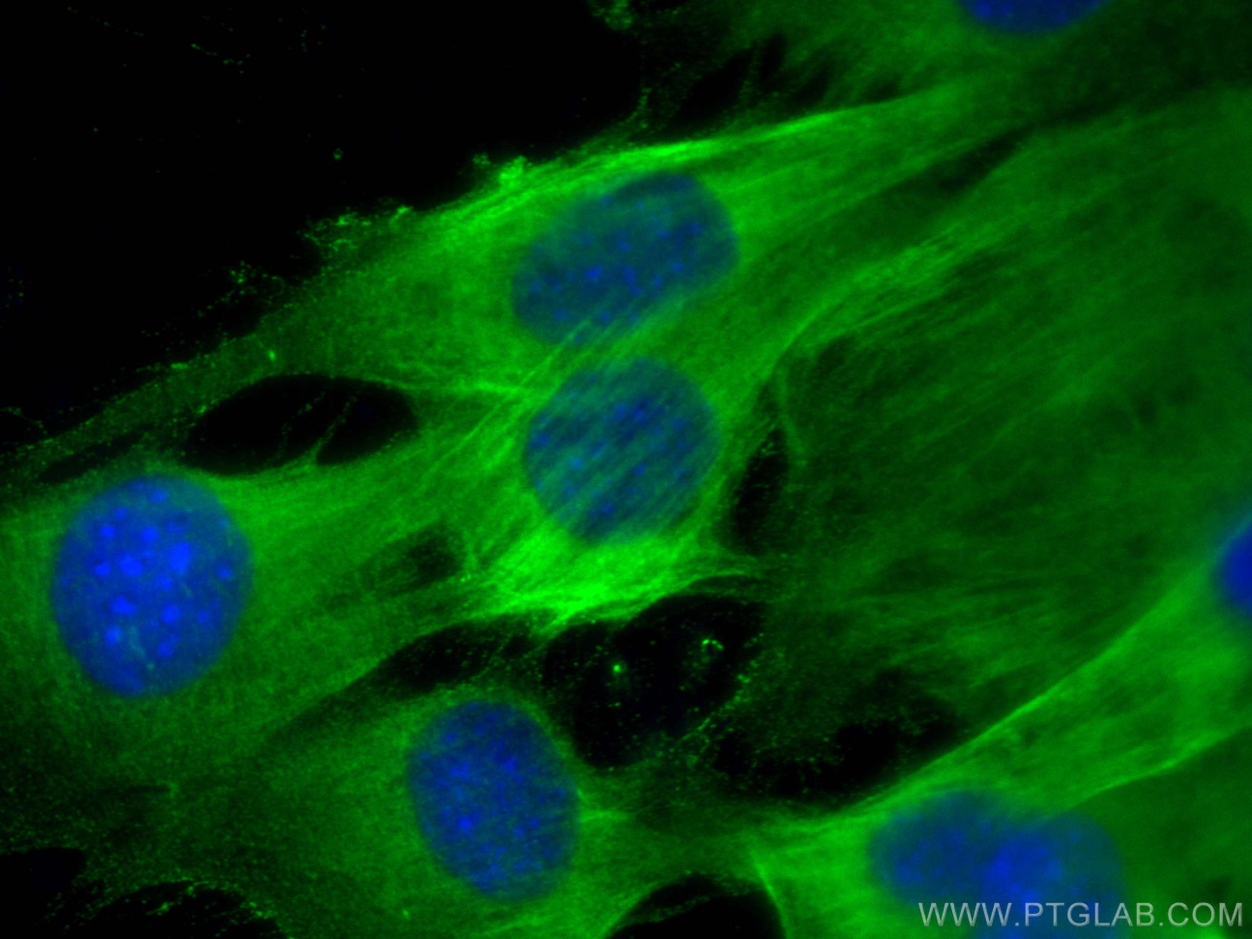 IF Staining of C2C12 using 13938-1-AP