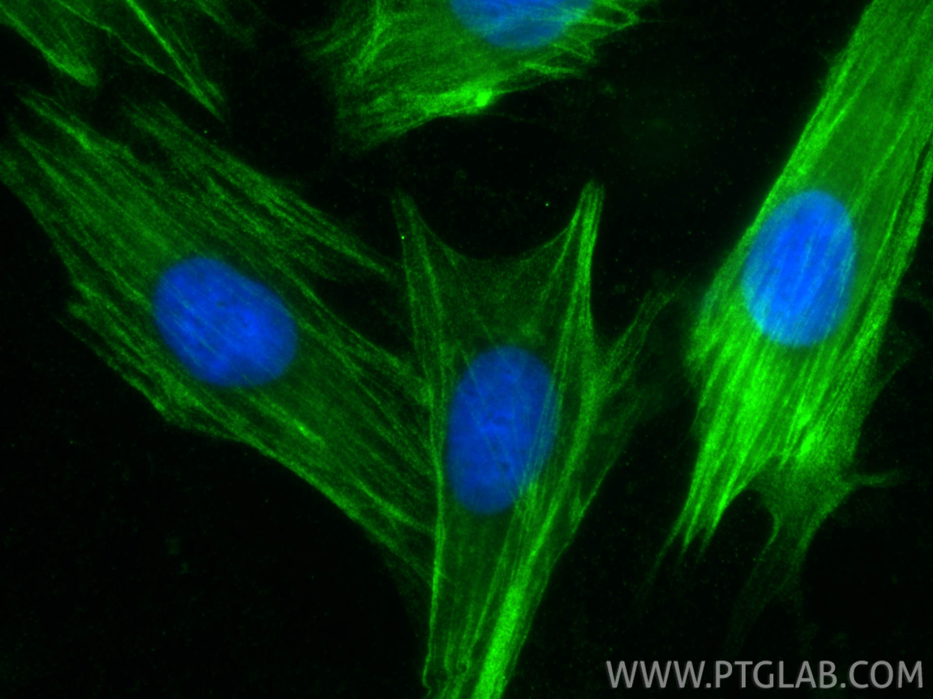 Immunofluorescent analysis of (-20°C Ethanol) fixed H9C2 cells using Calponin antibody (13938-1-AP) at dilution of 1:200 and CoraLite®488-Conjugated Goat Anti-Rabbit IgG(H+L) (<a class='green' href='/productredirect?CatalogNo=SA00013-2' target='_blank'>SA00013-2</a>). IF Staining of H9C2 using 13938-1-AP