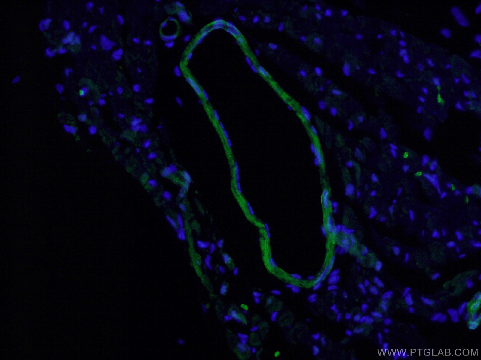 IF Staining of mouse heart using 13938-1-AP