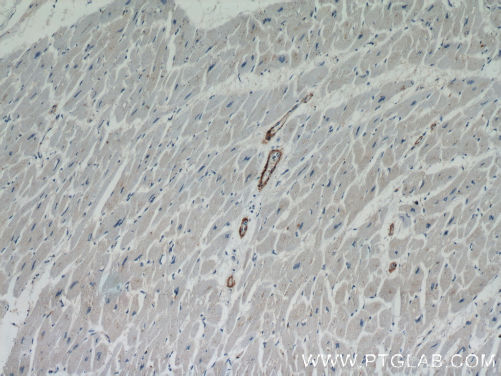 IHC staining of human heart using 13938-1-AP