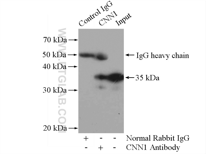 IP experiment of mouse lung using 13938-1-AP