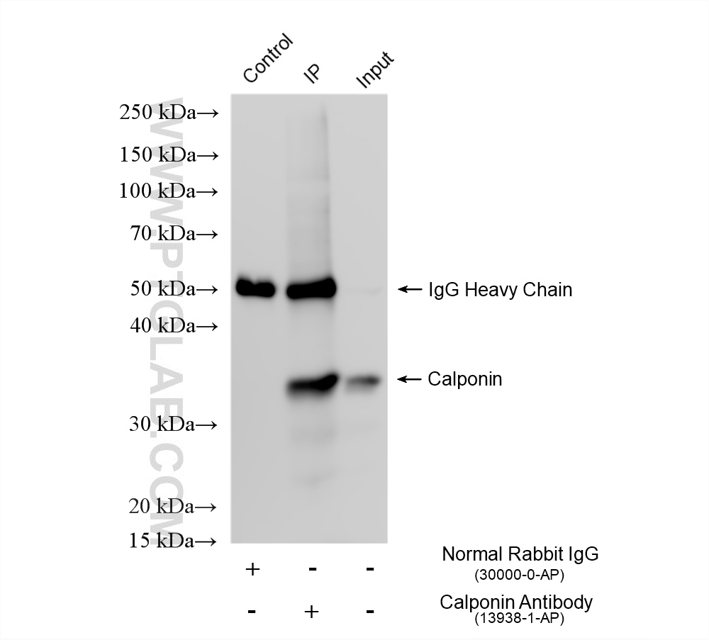 IP experiment of mouse heart using 13938-1-AP IP experiment of mouse heart using 13938-1-AP