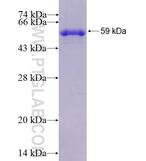 Calponin fusion protein Ag4989 SDS-PAGE