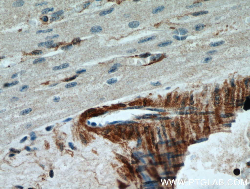 IHC staining of human heart using 21073-1-AP