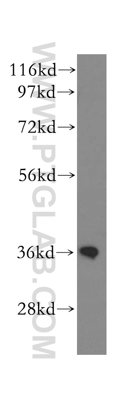 WB analysis of human kidney using 11509-1-AP