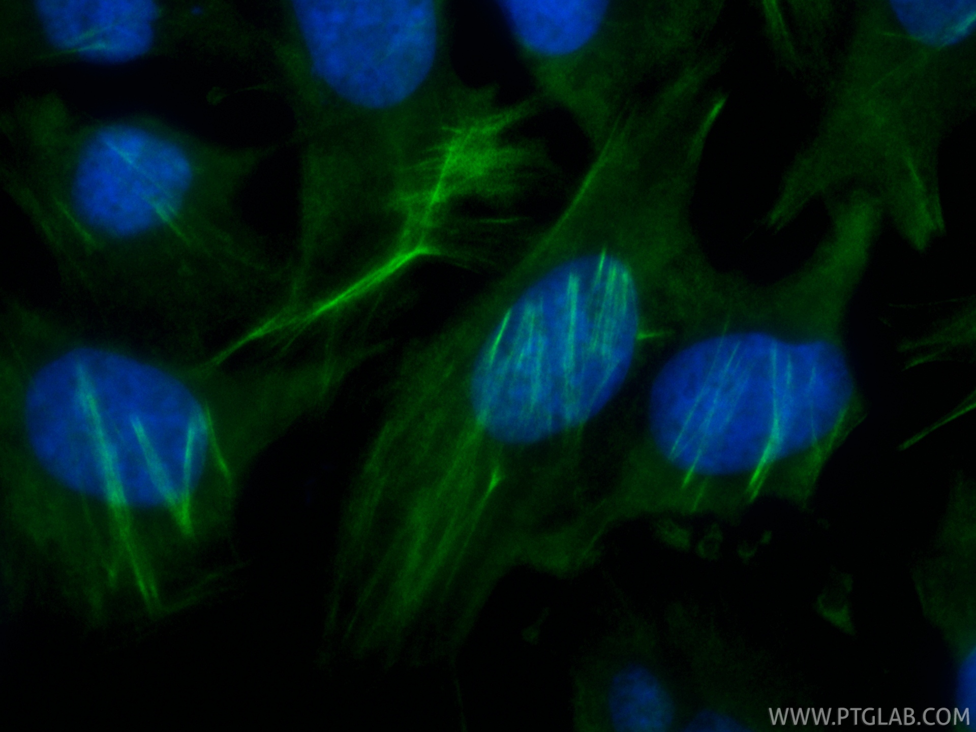 IF Staining of HeLa using CL488-86550-3 IF Staining of HeLa using CL488-86550-3
