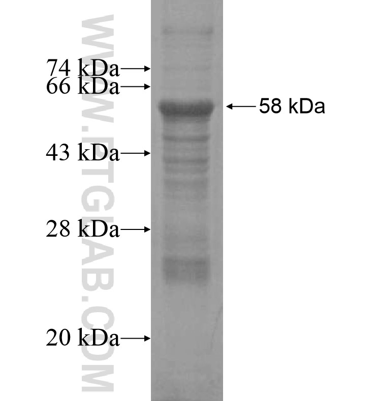 CNNM1 fusion protein Ag16411 SDS-PAGE CNNM1 fusion protein Ag16411 SDS-PAGE