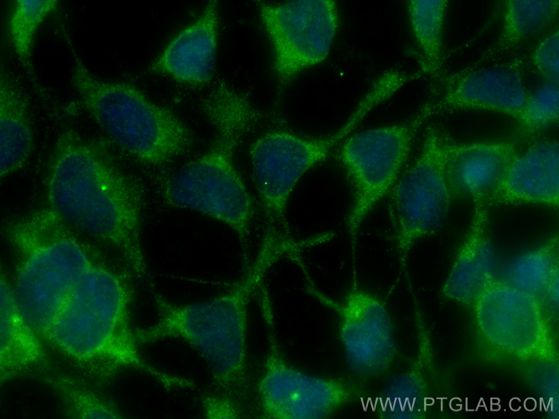 IF Staining of HEK-293 using 14276-1-AP