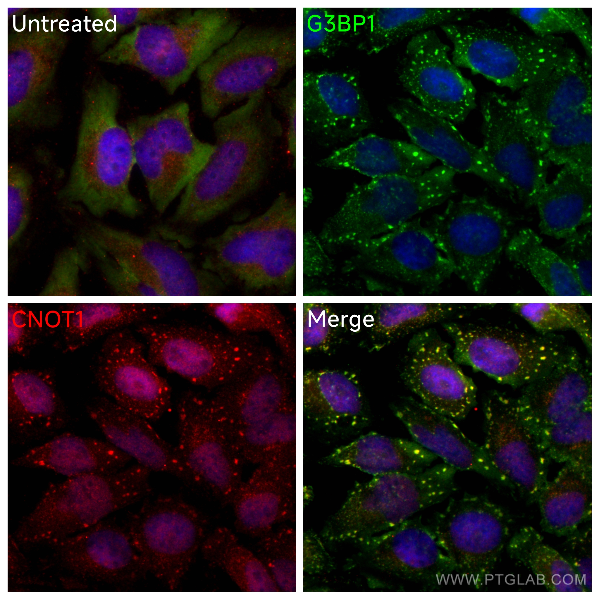 IF Staining of HeLa using 14276-1-AP