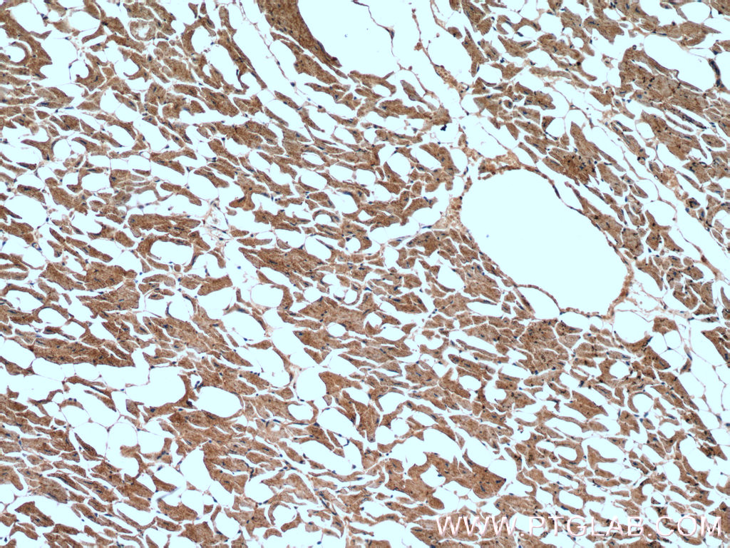 IHC staining of human heart using 14276-1-AP