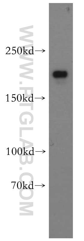 CNOT1 Polyclonal antibody