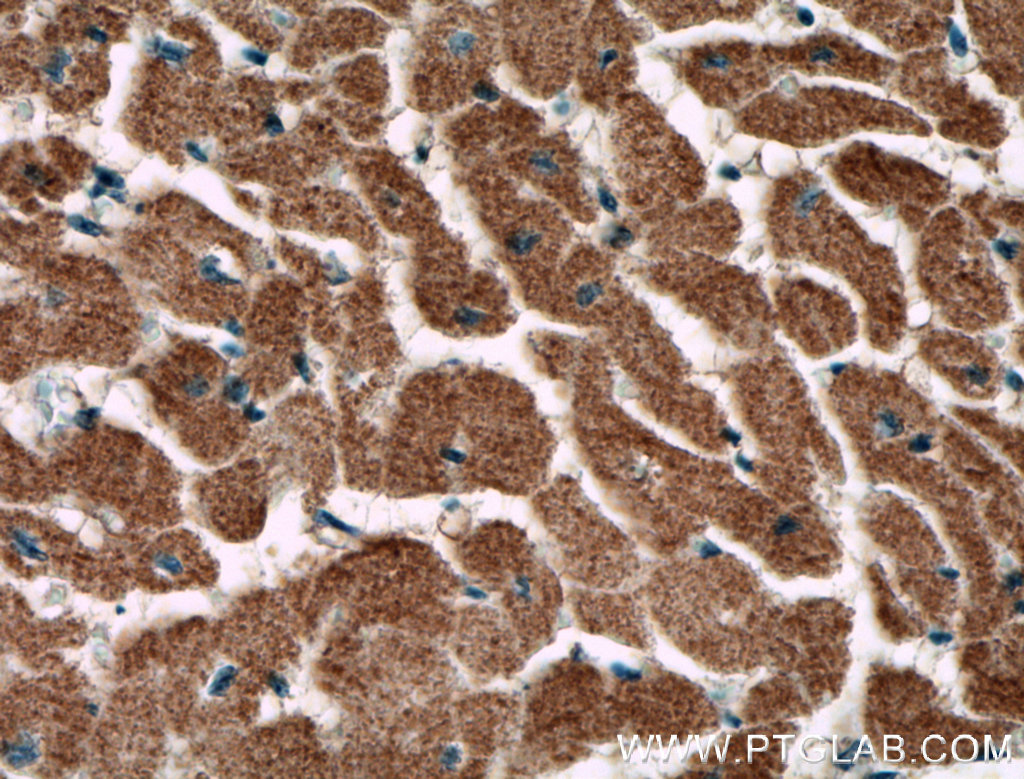 IHC staining of human heart using 66507-1-Ig (same clone as 66507-1-PBS)