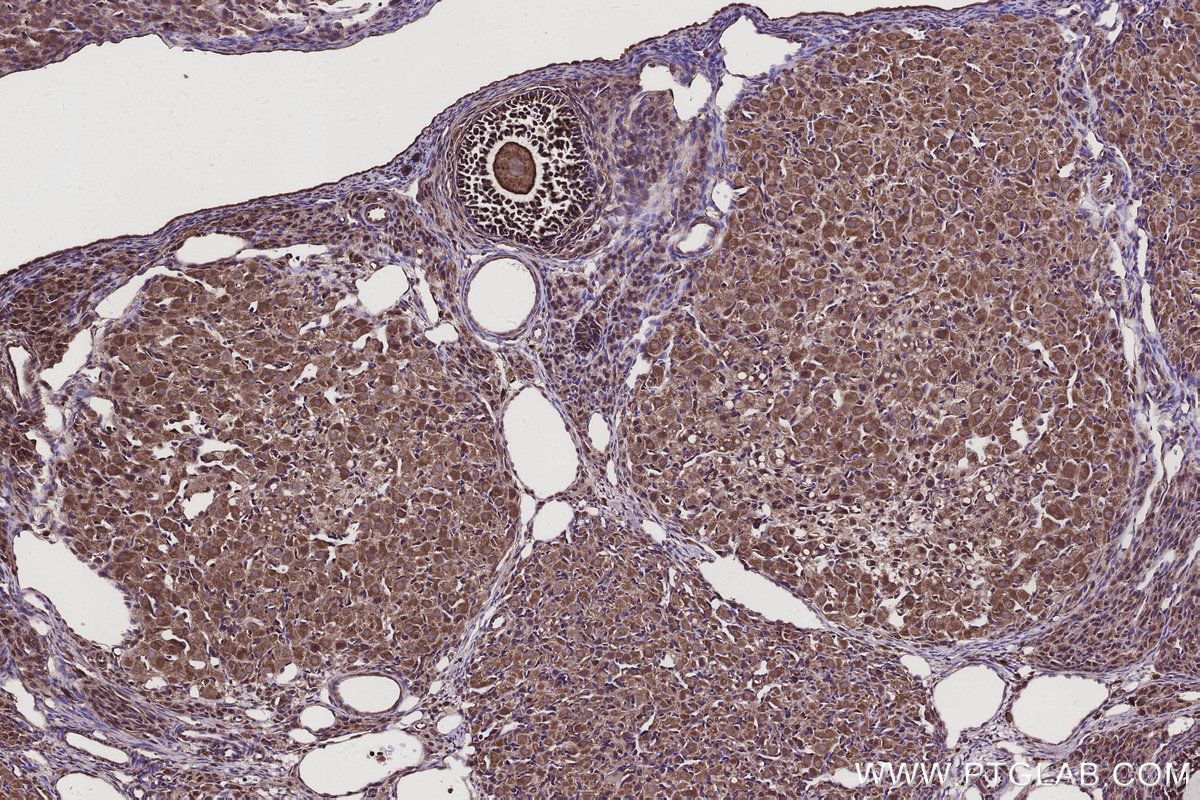 IHC staining of rat ovary using 15938-1-AP IHC staining of rat ovary using 15938-1-AP