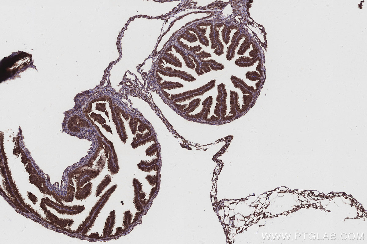 IHC staining of mouse ovary using 15938-1-AP IHC staining of mouse ovary using 15938-1-AP