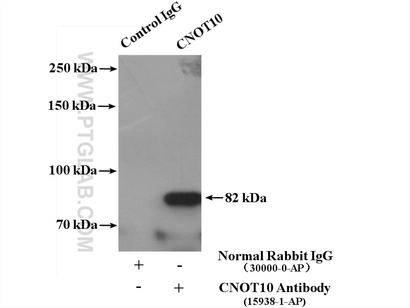 IP experiment of mouse brain using 15938-1-AP