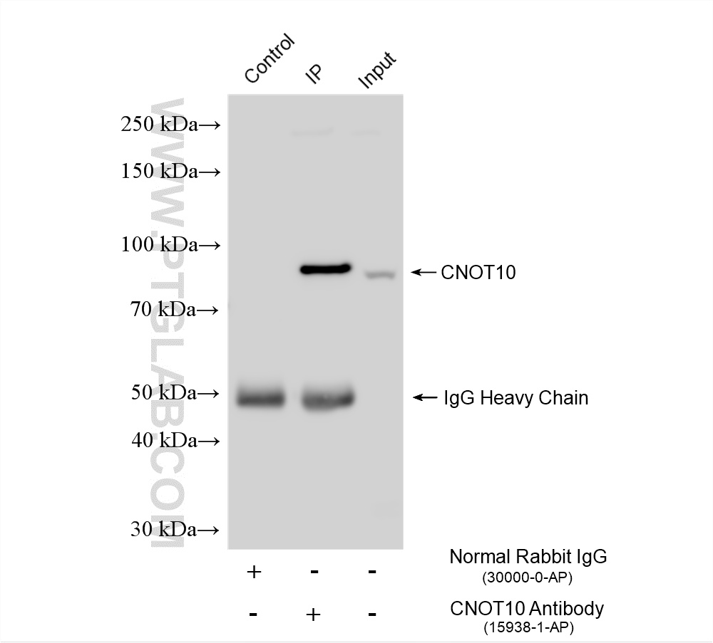 IP experiment of HeLa using 15938-1-AP