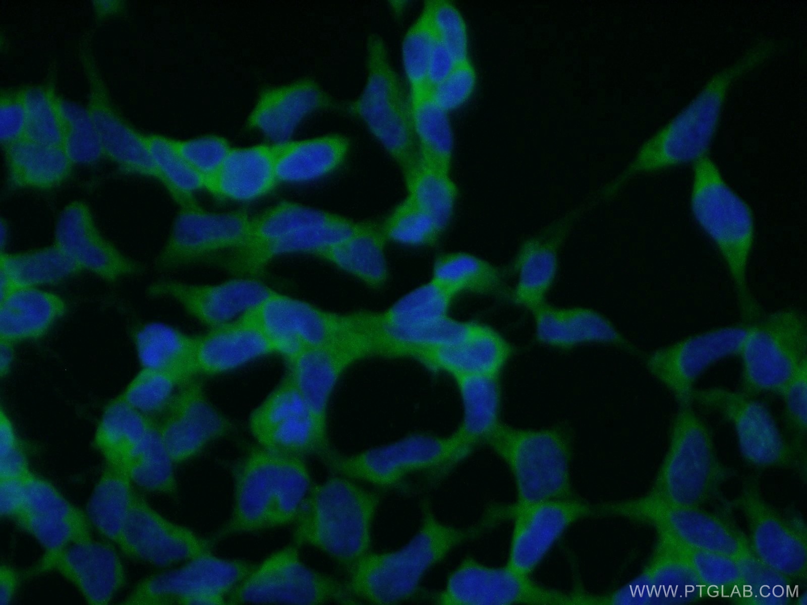 IF Staining of HEK-293 using 10313-1-AP