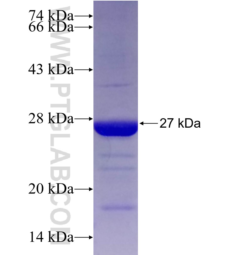 CNOT2 fusion protein Ag20553 SDS-PAGE