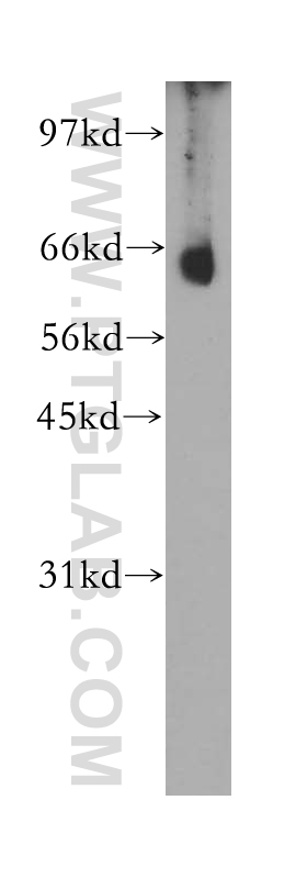 WB analysis of mouse skeletal muscle using 12564-1-AP