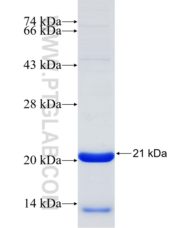 CNOT4 fusion protein Ag30968 SDS-PAGE CNOT4 fusion protein Ag30968 SDS-PAGE