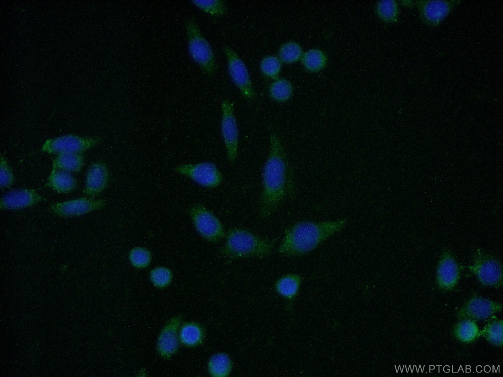 IF Staining of HeLa using 10752-1-AP