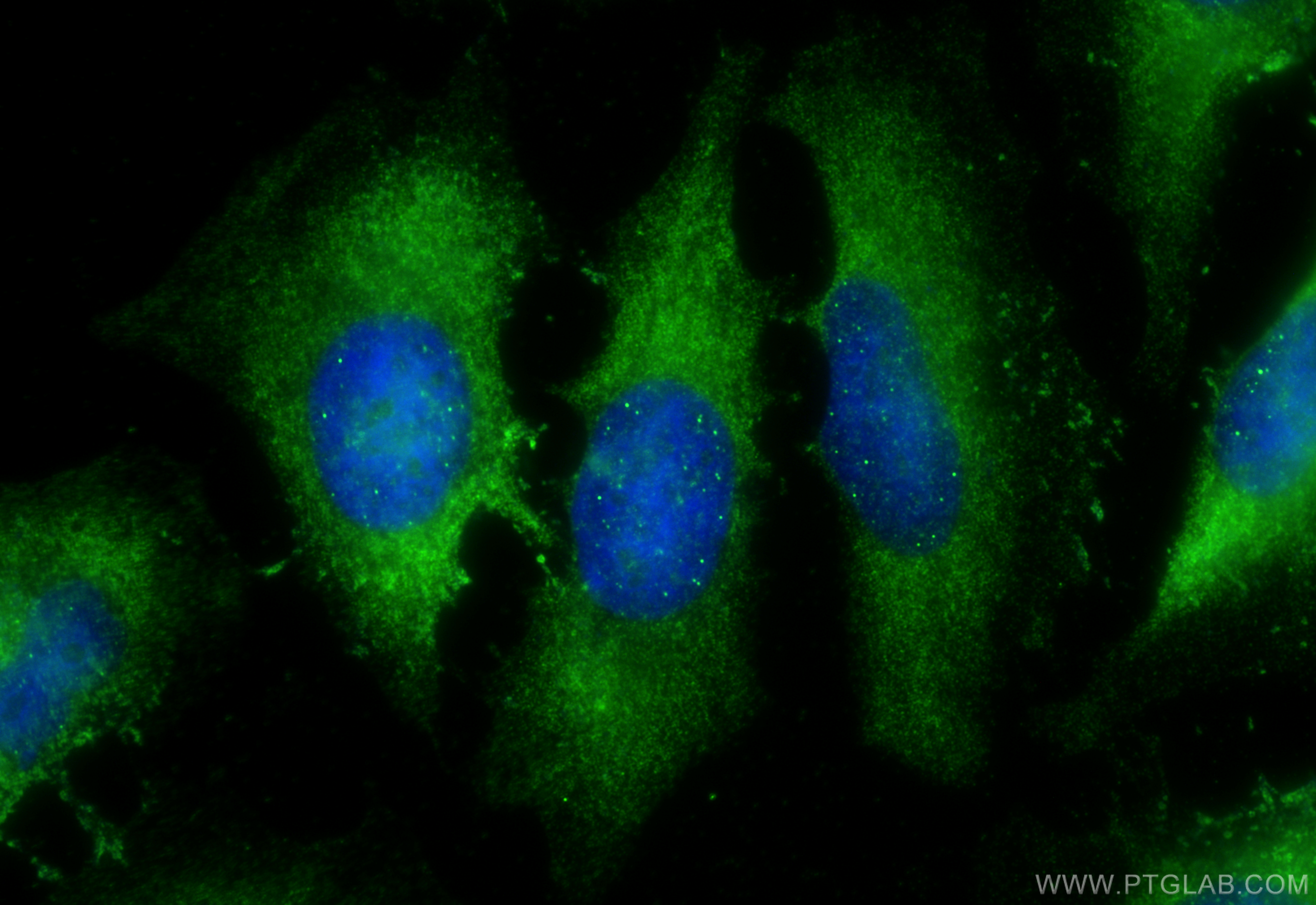 IF Staining of HeLa using 10752-1-AP (same clone as 10752-1-PBS)