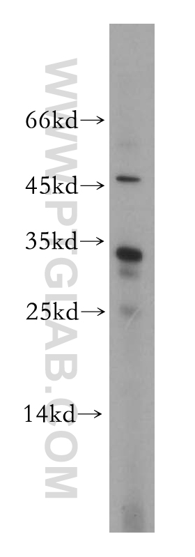 CNOT8 Polyclonal antibody