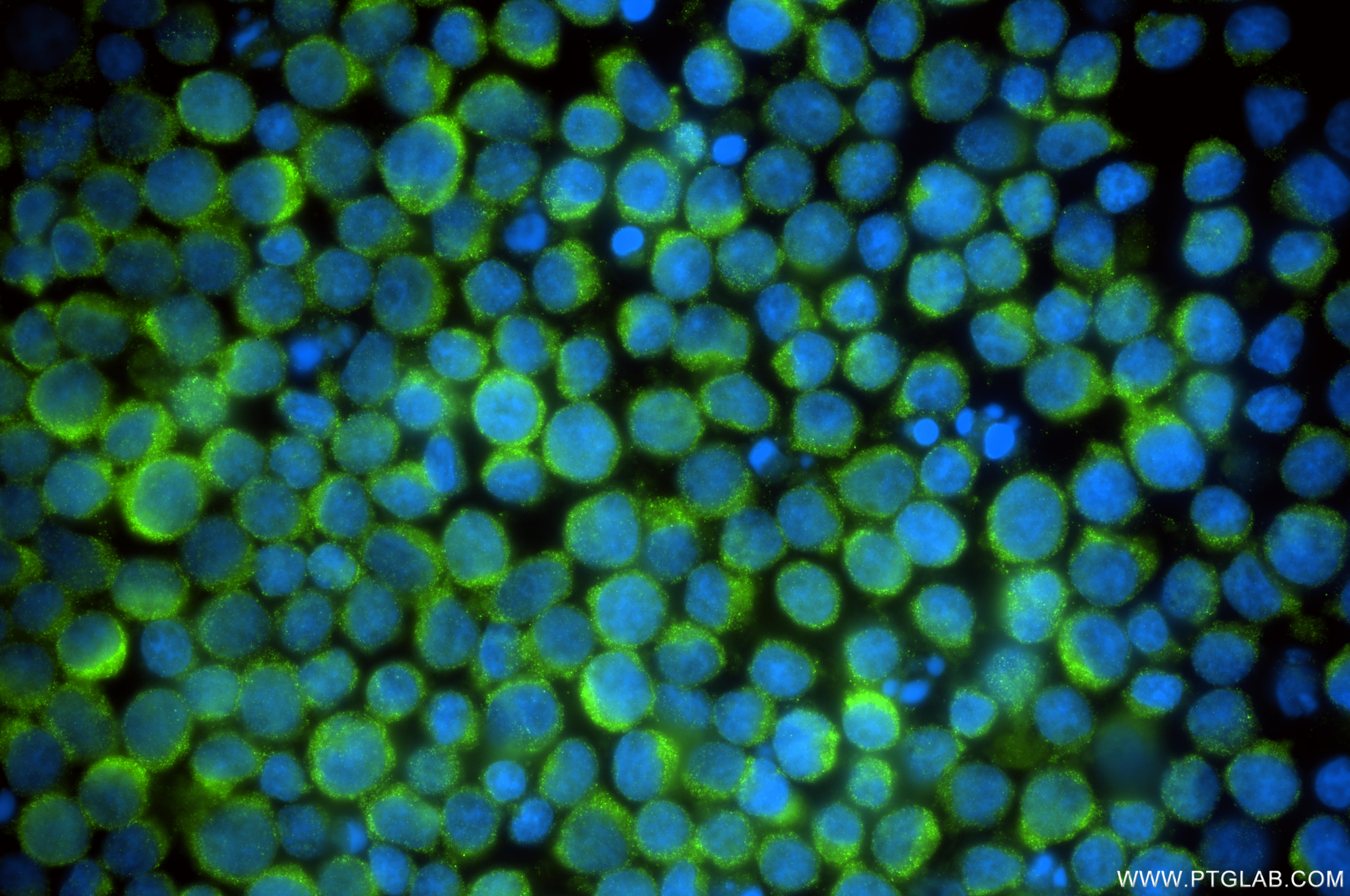 IF Staining of Jurkat using 86091-1-RR